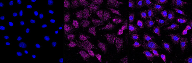 TRIP10 Antibody in Immunocytochemistry (ICC/IF)