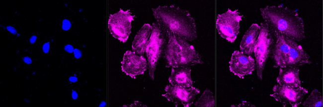 WDR1 Antibody in Immunocytochemistry (ICC/IF)