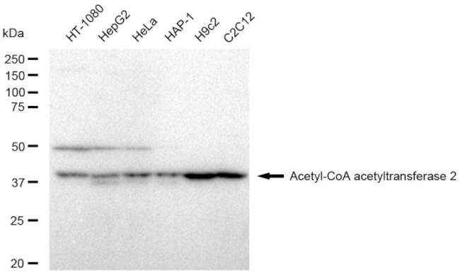 ACAT2 Antibody in Western Blot (WB)