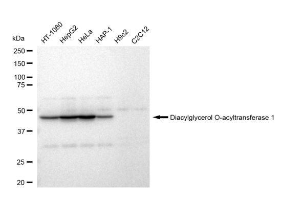 DGAT1 Antibody in Western Blot (WB)