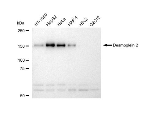 Desmoglein 2 Antibody in Western Blot (WB)