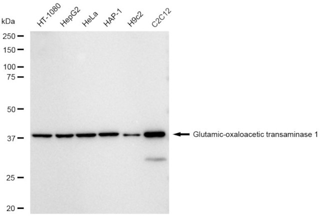 GOT1 Antibody in Western Blot (WB)