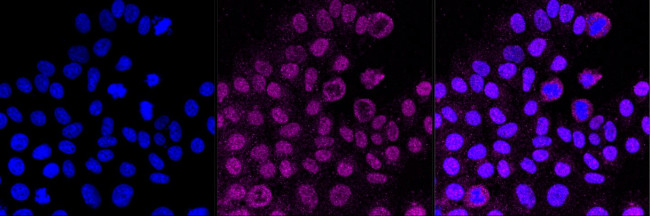 Cdc42 Antibody in Immunocytochemistry (ICC/IF)