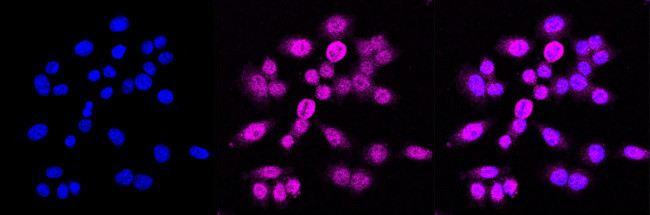 EEF2 Antibody in Immunocytochemistry (ICC/IF)