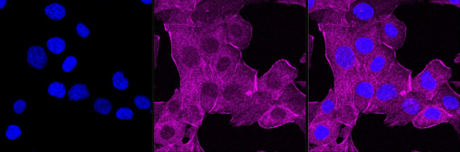 DEGS1 Antibody in Immunocytochemistry (ICC/IF)