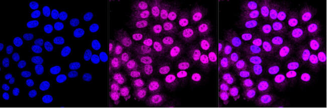 PCTAIRE1 Antibody in Immunocytochemistry (ICC/IF)