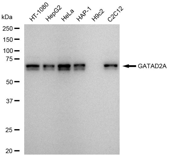 GATAD2A Antibody in Western Blot (WB)