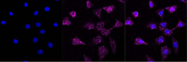 FOXO4 Antibody in Immunocytochemistry (ICC/IF)