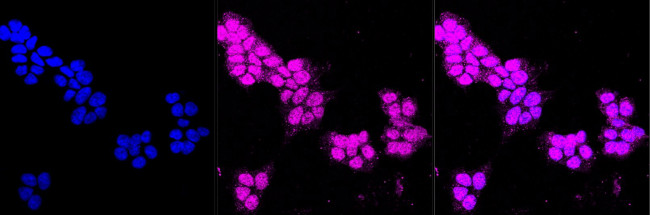 GAP43 Antibody in Immunocytochemistry (ICC/IF)