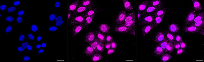 HDAC4 Antibody in Immunocytochemistry (ICC/IF)