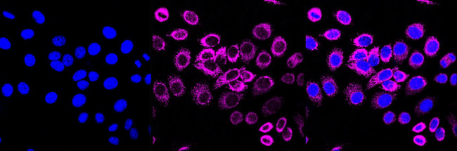 Glutaminase Antibody in Immunocytochemistry (ICC/IF)