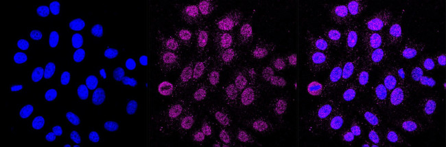 G6PD Antibody in Immunocytochemistry (ICC/IF)