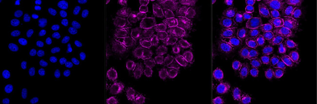 Flotillin 1 Antibody in Immunocytochemistry (ICC/IF)