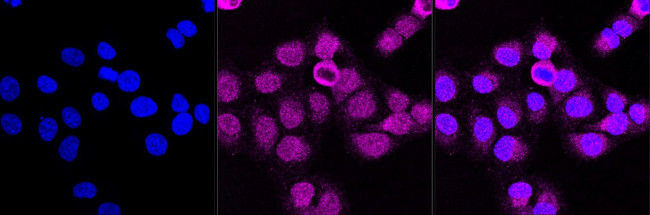 ITGB1 Antibody in Immunocytochemistry (ICC/IF)