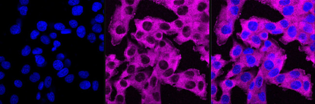 PKC alpha Antibody in Immunocytochemistry (ICC/IF)