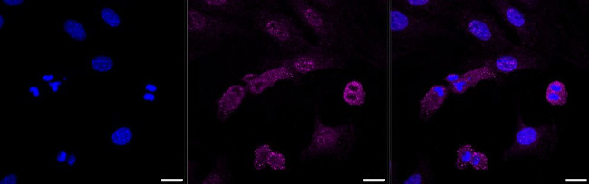 Alpha-Smooth Muscle Actin Antibody in Immunocytochemistry (ICC/IF)