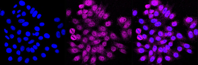 VAMP2 Antibody in Immunocytochemistry (ICC/IF)