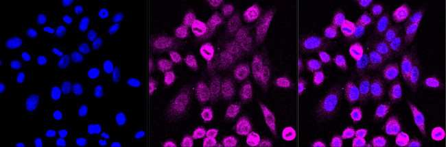 PACT Antibody in Immunocytochemistry (ICC/IF)