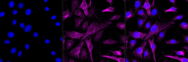 PRAS40 Antibody in Immunocytochemistry (ICC/IF)