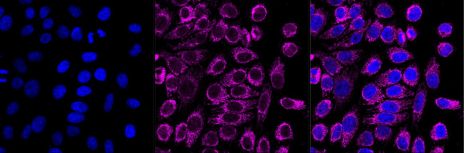 CLPP Antibody in Immunocytochemistry (ICC/IF)