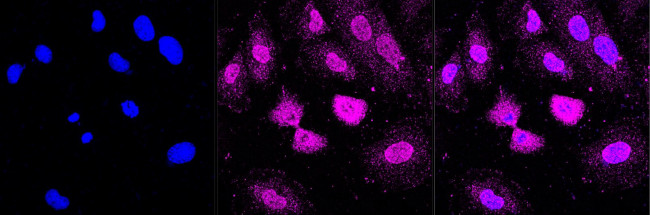 BMP-6 Antibody in Immunocytochemistry (ICC/IF)