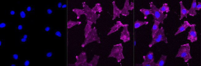 Aquaporin 1 Antibody in Immunocytochemistry (ICC/IF)