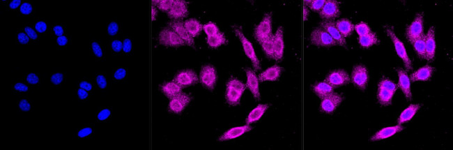 Ferritin Heavy Chain Antibody in Immunocytochemistry (ICC/IF)