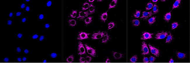 ACADS Antibody in Immunocytochemistry (ICC/IF)