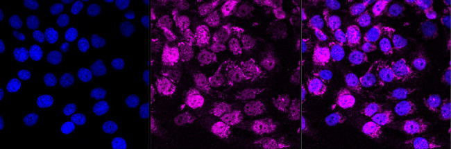 ACAT1 Antibody in Immunocytochemistry (ICC/IF)