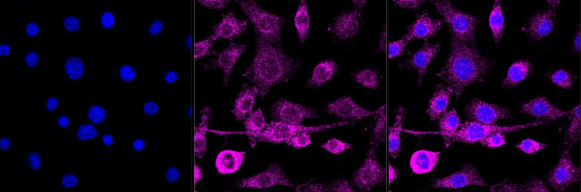 Arp3 Antibody in Immunocytochemistry (ICC/IF)