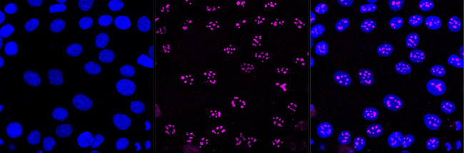 BAF53A Antibody in Immunocytochemistry (ICC/IF)