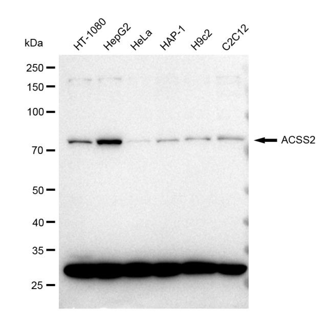 ACSS2 Antibody in Western Blot (WB)