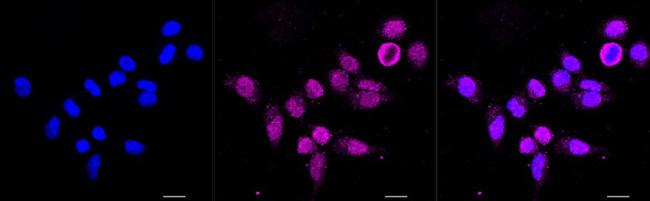 DAXX Antibody in Immunocytochemistry (ICC/IF)