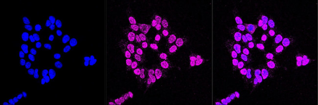 Adenosine Kinase Antibody in Immunocytochemistry (ICC/IF)