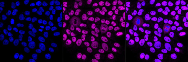 CAF1 p150 Antibody in Immunocytochemistry (ICC/IF)