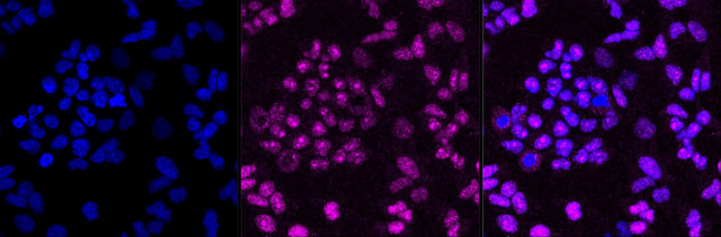 BMI-1 Antibody in Immunocytochemistry (ICC/IF)