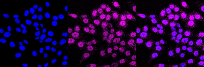 Annexin A7 Antibody in Immunocytochemistry (ICC/IF)