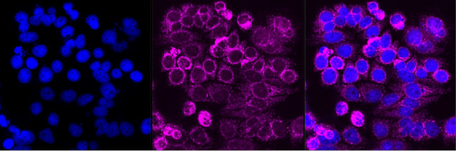 C1QBP Antibody in Immunocytochemistry (ICC/IF)