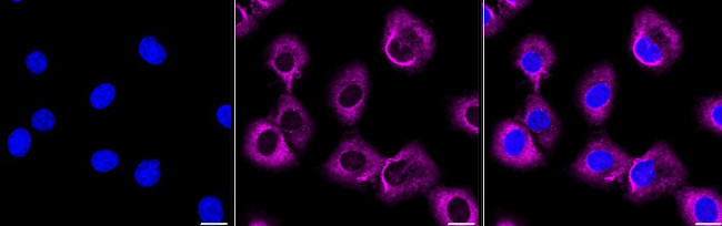 Arginase 2 Antibody in Immunocytochemistry (ICC/IF)