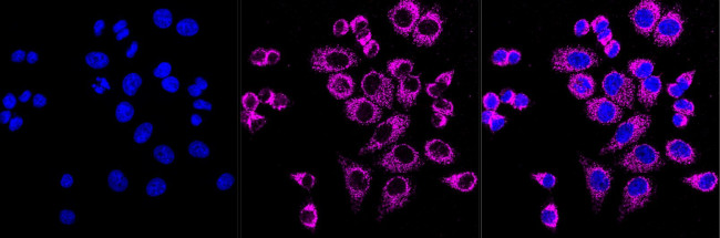 GRSF1 Antibody in Immunocytochemistry (ICC/IF)