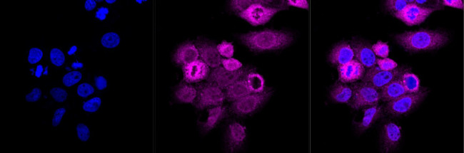 GSK3 alpha Antibody in Immunocytochemistry (ICC/IF)