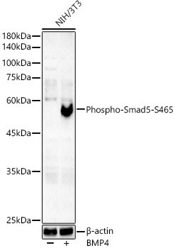 Phospho-SMAD5 (Ser465) Antibody in Western Blot (WB)