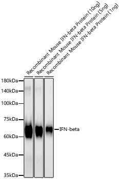 IFN beta Antibody in Western Blot (WB)