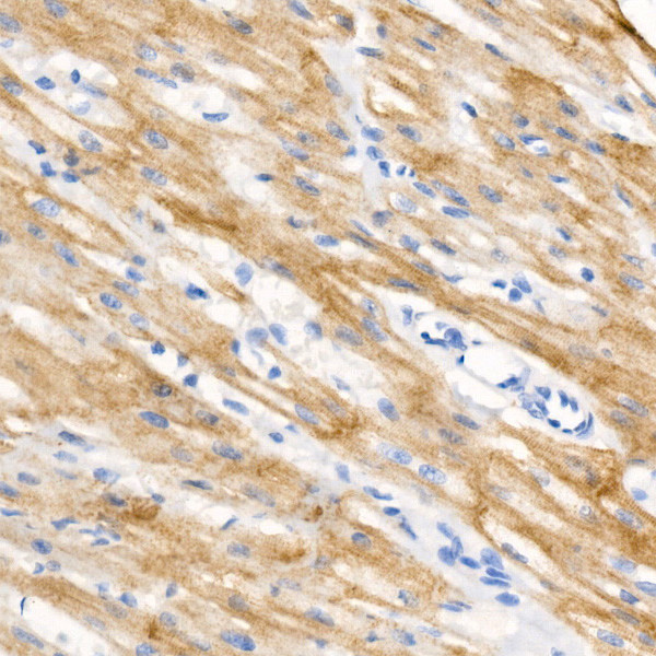 Phospho-Cardiac Troponin I (Ser23, Ser24) Antibody in Immunohistochemistry (Paraffin) (IHC (P))