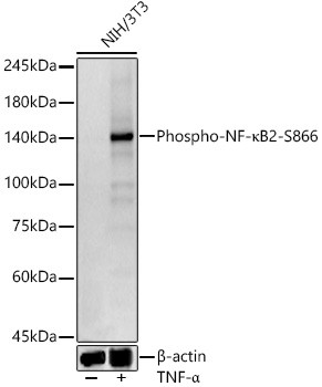 Phospho-NFkB-p100 (Ser866) Antibody in Western Blot (WB)