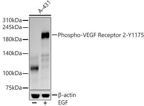 Phospho-VEGF Receptor 2 (Tyr1175) Antibody in Western Blot (WB)