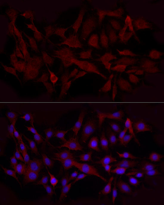 Beclin 1 Antibody in Immunocytochemistry (ICC/IF)