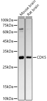 CDK5 Antibody in Western Blot (WB)