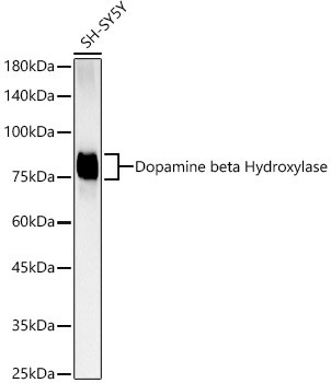 Dopamine beta Hydroxylase Antibody in Western Blot (WB)