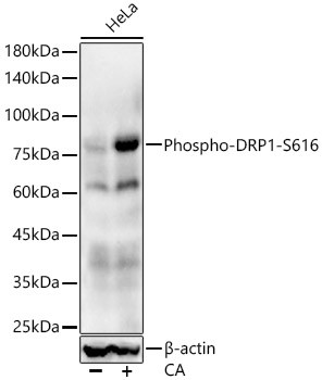 Phospho-DNM1L (Ser616) Antibody in Western Blot (WB)